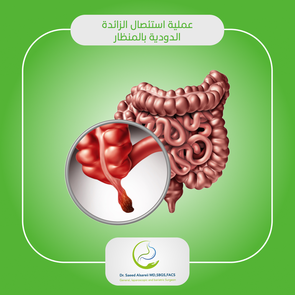 402086494 (1) الزائدة الدودية