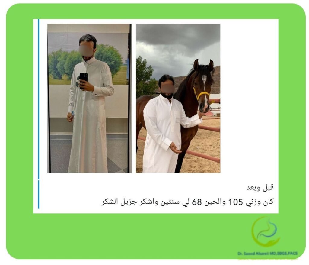 مرضى فقدوا الوزن