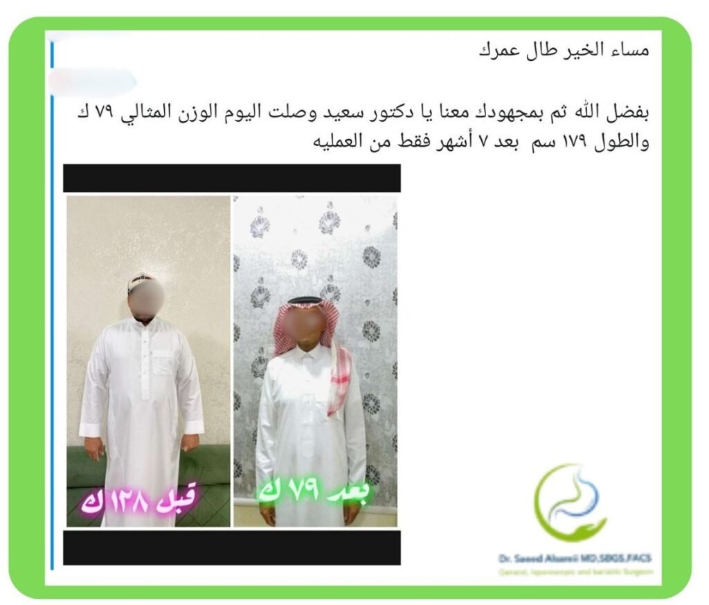 علاج السمنة