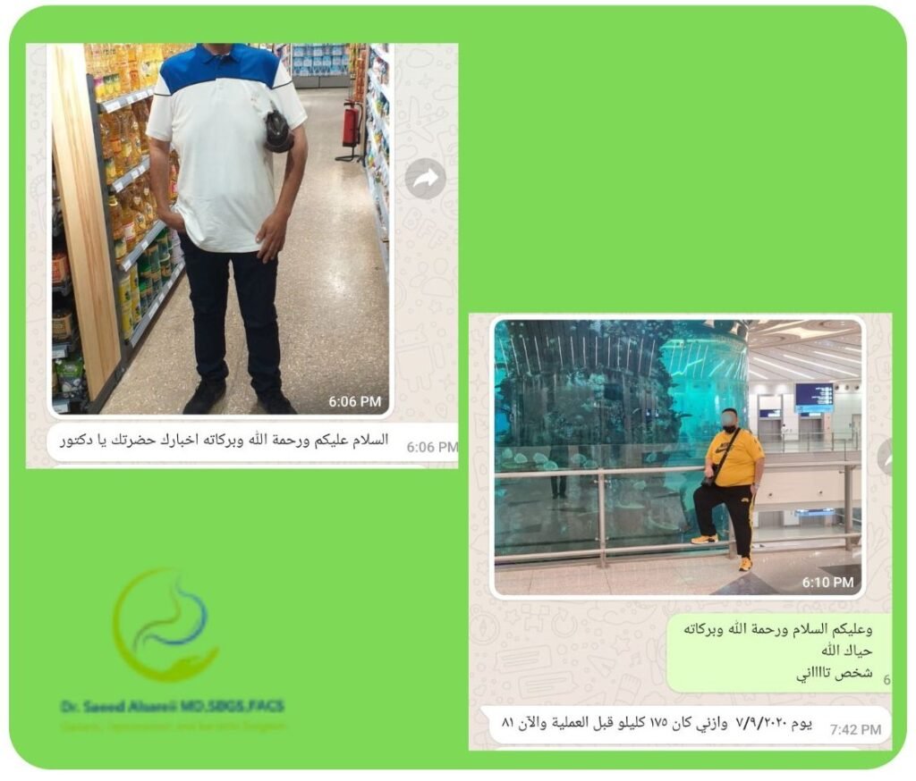 مرضى فقدوا الوزن