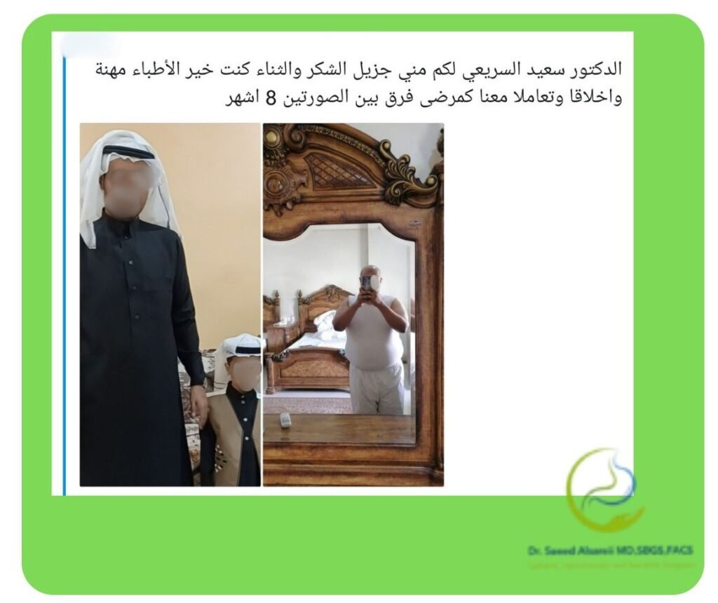 آراء المرضى