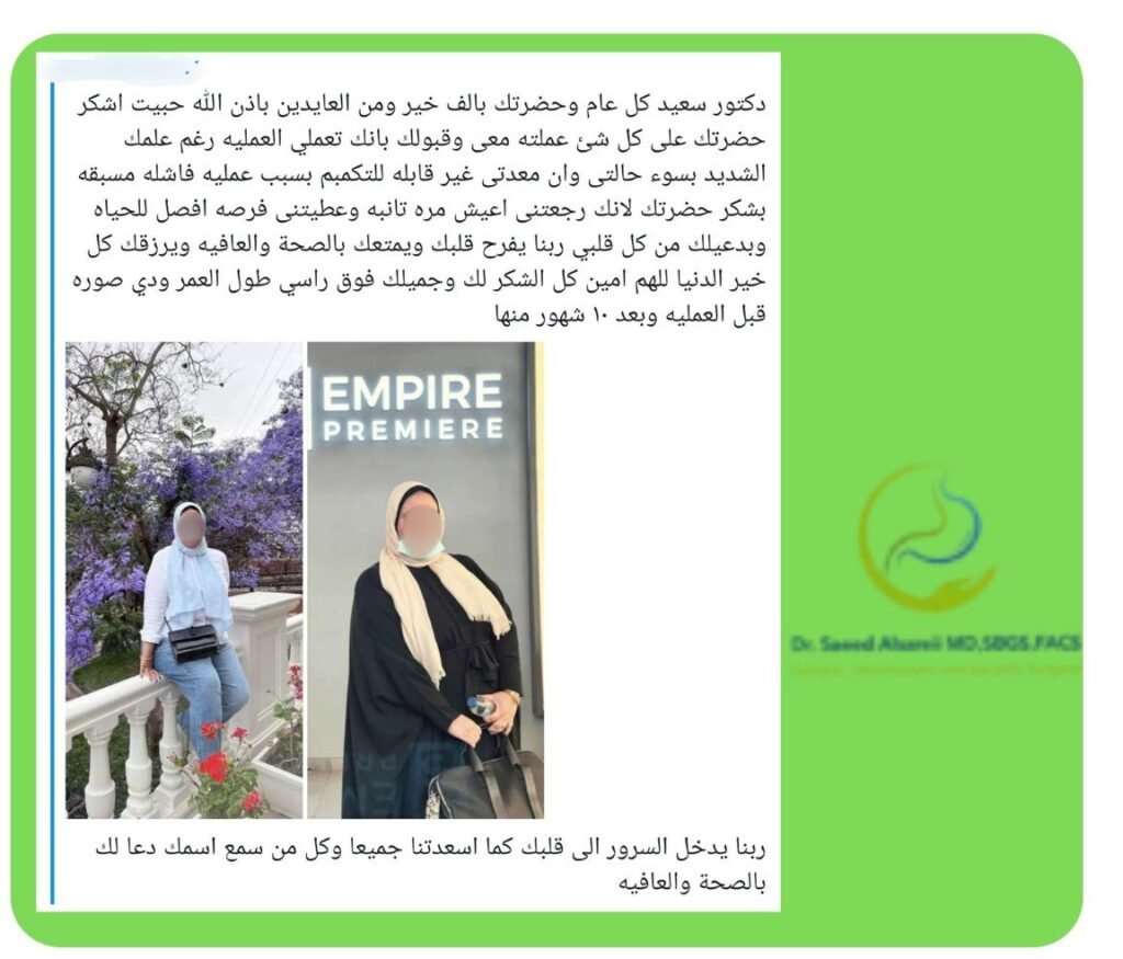 علاج السمنة