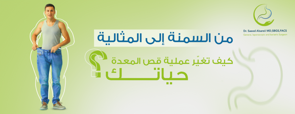 كل ما تحتاج معرفته عن فوائد ومخاطر عملية قص المعدة