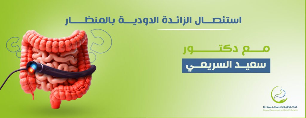 استئصال الزائدة الدودية بالمنظار​ حل لتجنب المضاعفات