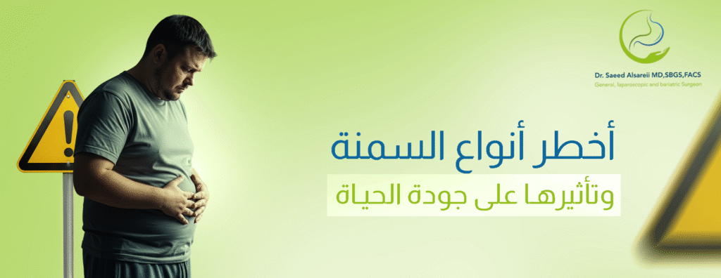 أخطر انواع السمنة وأهم مخاطرها على الصحة